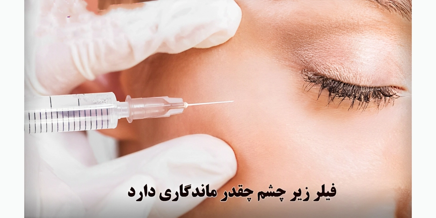 ماندگاری ژل نورامیس چقدر است