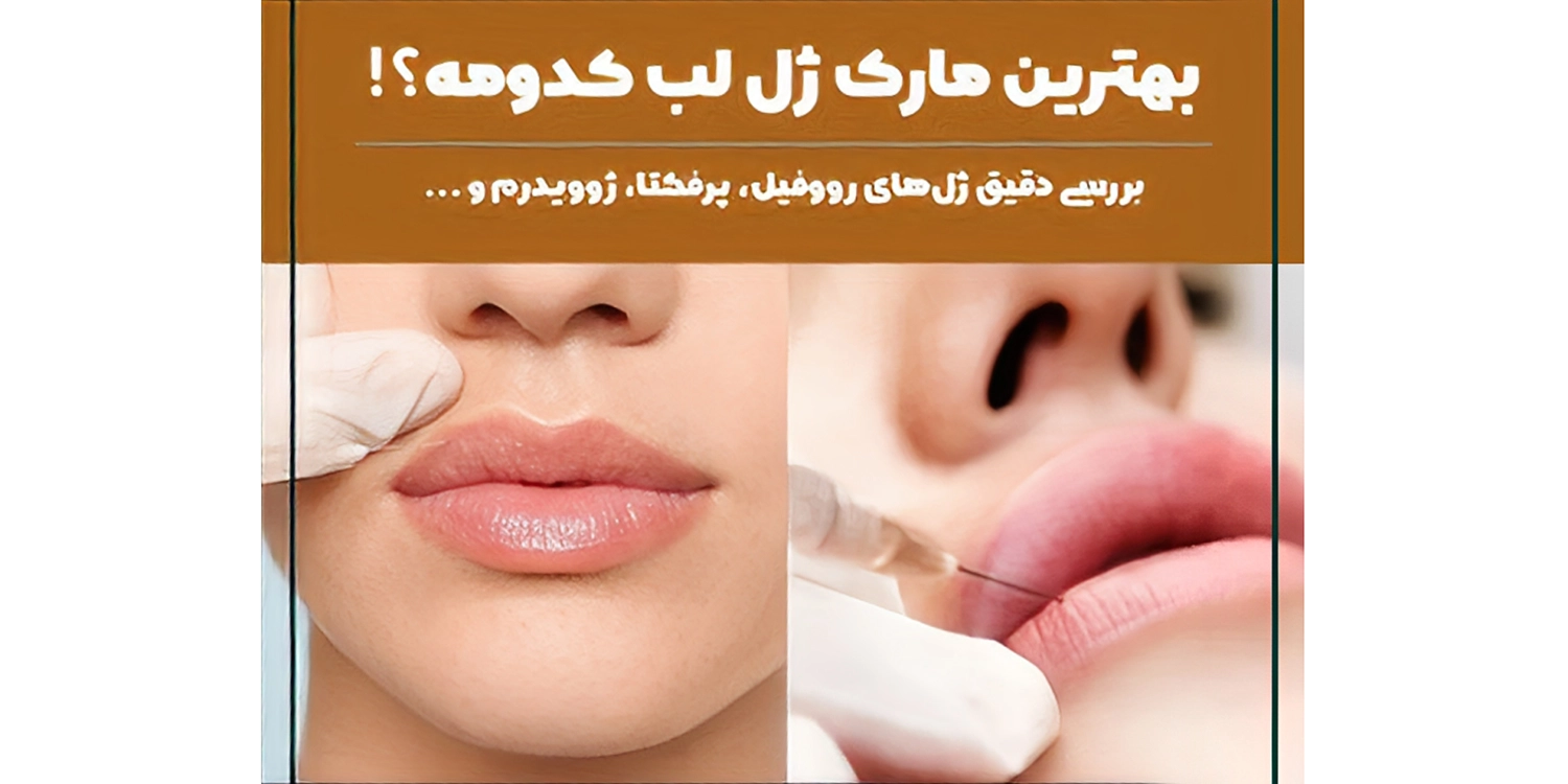 بهترین مارک فیلر لب چیست
