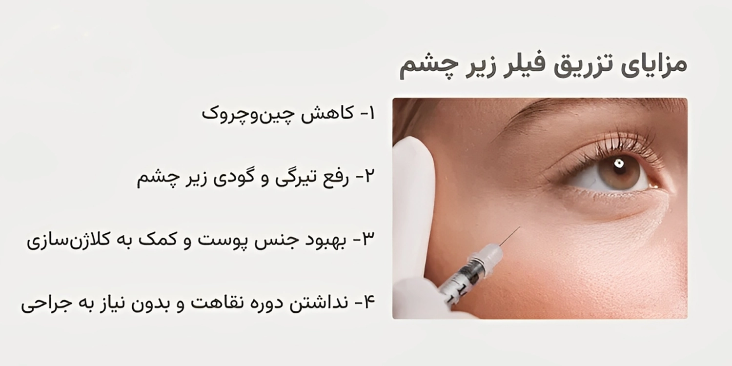بهترین برند برای تزریق فیلر زیر چشم