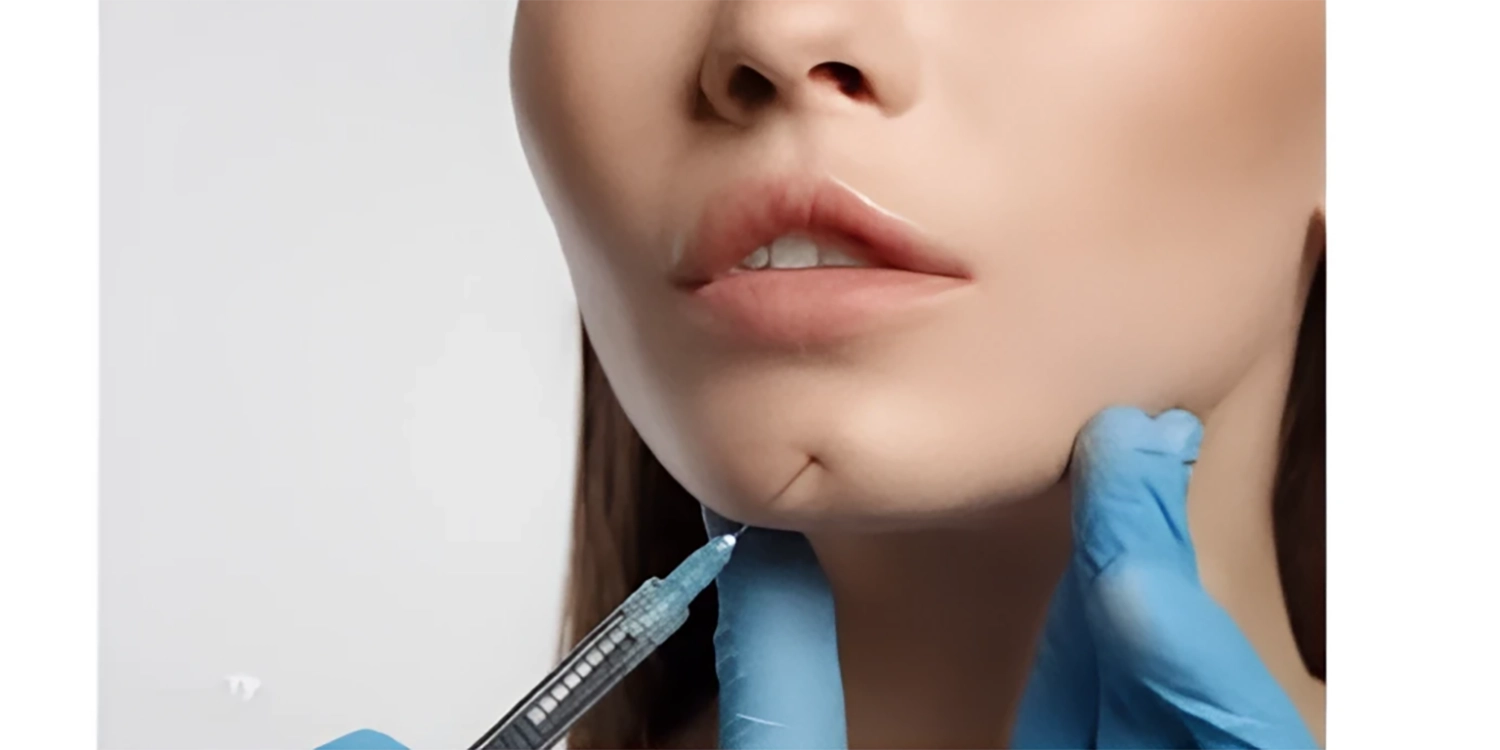 تقویت فک و ایجاد تعادل چهره با فیلر چانه